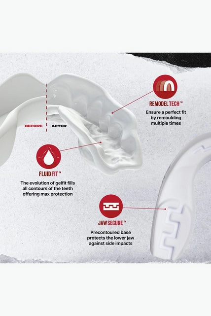 SAFEJAWZ  Mouthguard